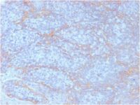 Formalin-fixed, paraffin embedded human tonsil sections stained with 100 ul anti-Beta Catenin (clone CTNNB1/2098) at 1:50. HIER epitope retrieval prior to staining was performed in 10mM Citrate, pH 6.0.